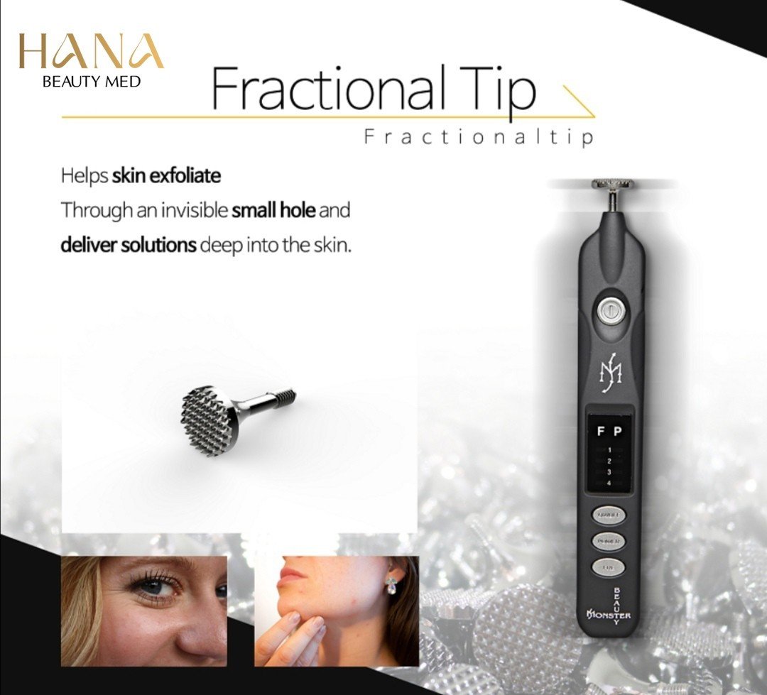 dau-may-fractional-tip